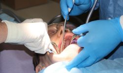 dental-surgery